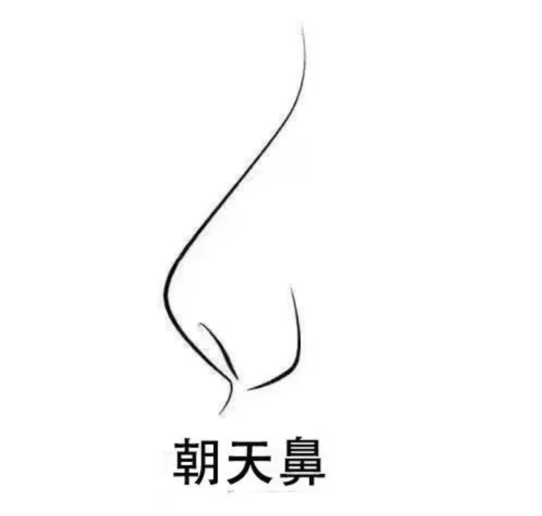 鼻梁又塌又短、鼻头粗大外翻，缺点集中的鼻子如何变美? 图片-8