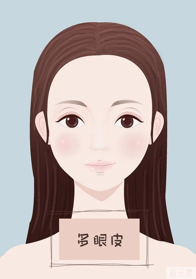 整形无小事丨埋线双眼皮，为什么选择的人变少了? 图片-3