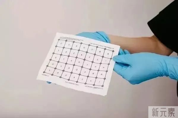 热玛吉治疗全过程，做完你就知道这个银子没白花! 图片-6