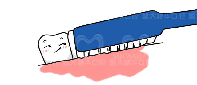 刷牙时感觉牙酸?小心是楔状缺损! 图片-8