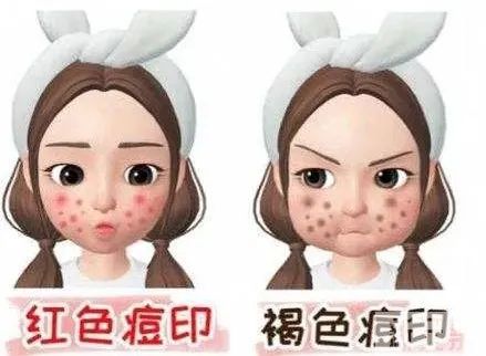 不同时期 的战痘经验 图片-2