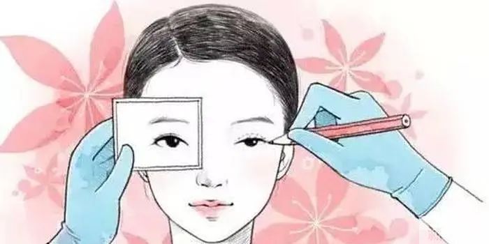 双眼皮和上睑下垂有什么关系? 图片-8