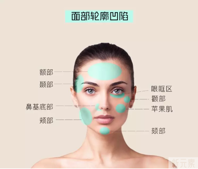 自体脂肪全面部填充会显脸大吗? 图片-2
