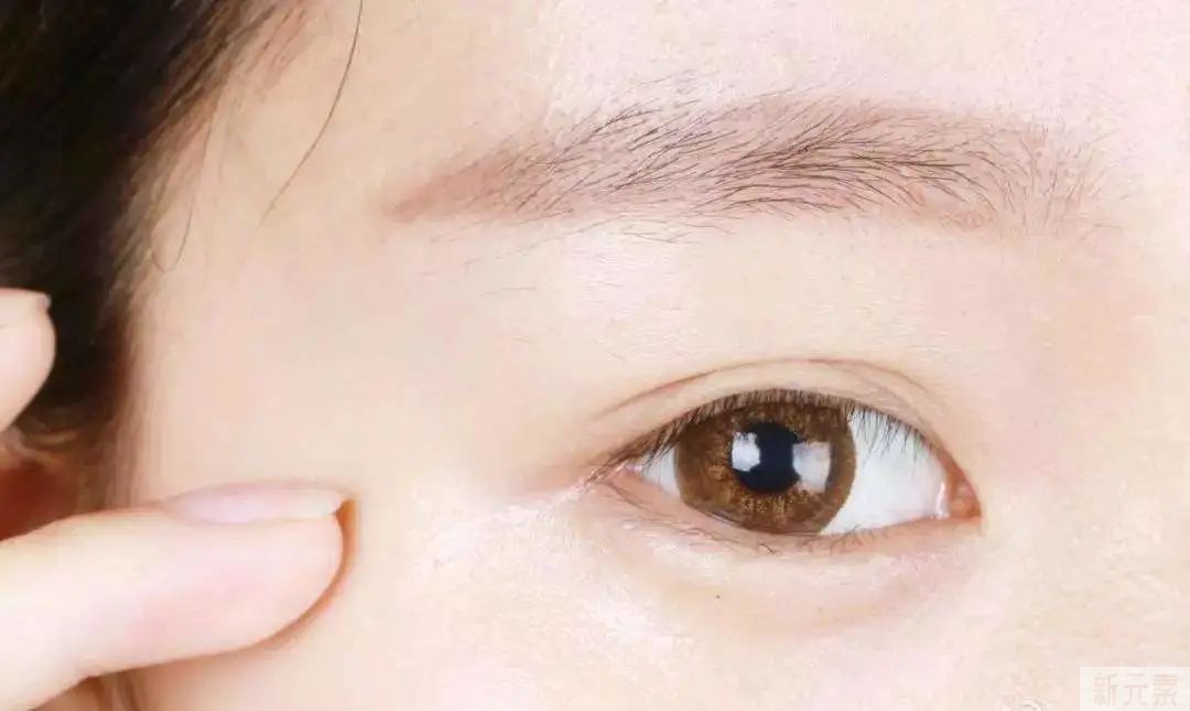 为什么眼周的皮肤这么容易衰老? 图片-6