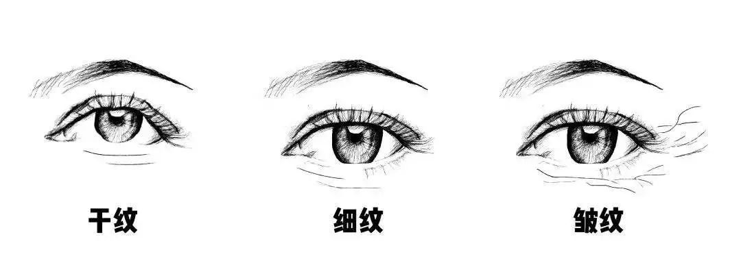 科普——眼周肌肤总是暗沉，怎么办? 图片-5