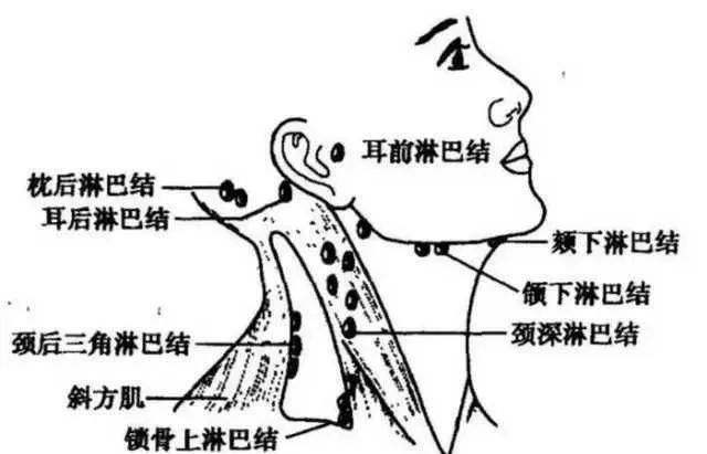 这个部位千万不能吸脂! 图片-6