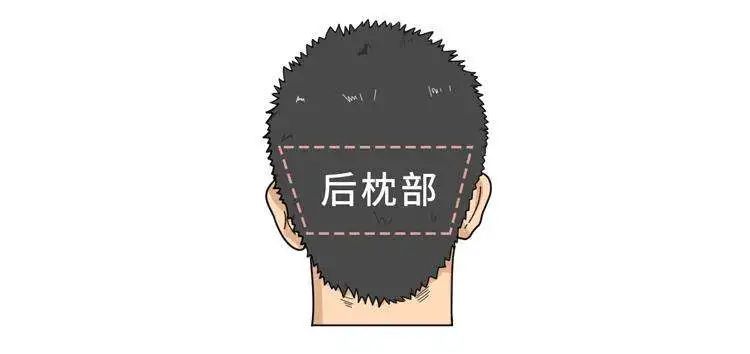 哪些因素会影响植发后的毛囊成活率? 图片-5