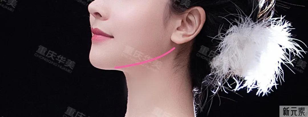 磨骨后一眼就能被识破?5个关于磨骨的误区，骗了多少人 图片-7