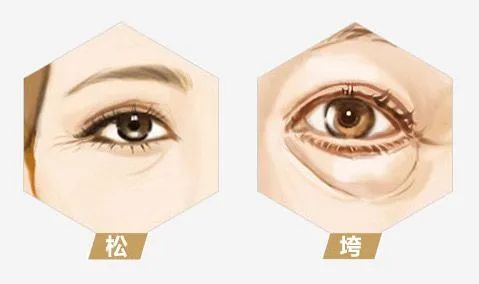 改善眼周皱纹，太简单了! 图片-3