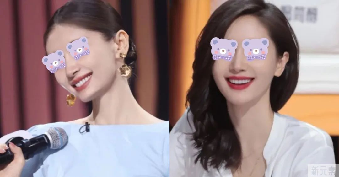 同样是填充，为啥你是“馒头脸”，别人却自然减龄?避坑这3点 图片-2
