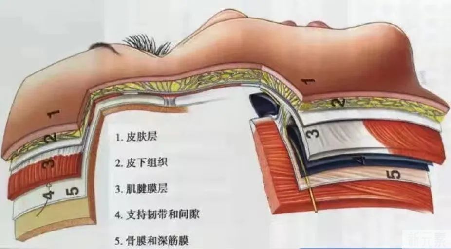 同样是填充，为啥你是“馒头脸”，别人却自然减龄?避坑这3点 图片-3
