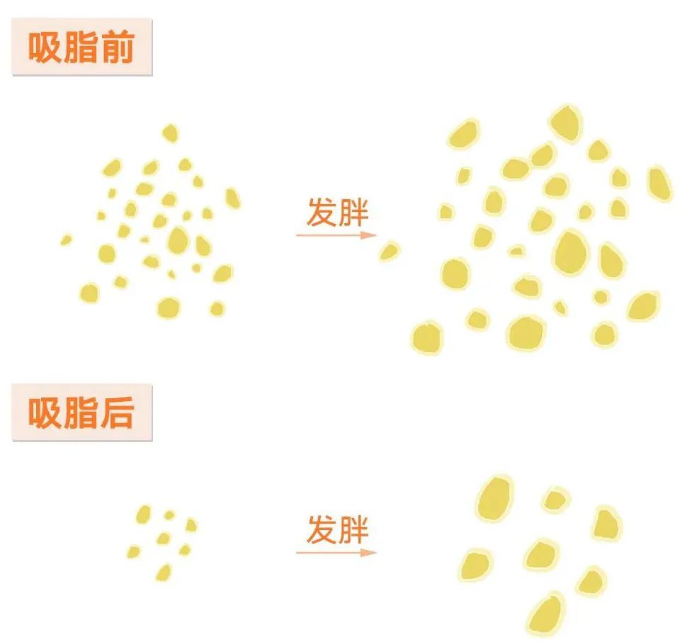 快过年了，吸脂之后可以「报复性」大吃大喝吗? 图片-6