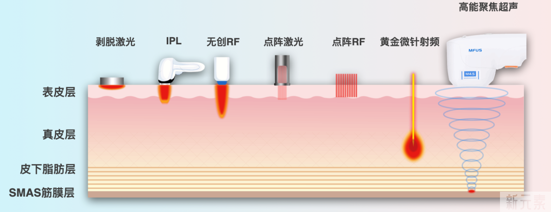 一分钟告诉你，到底适不适合做超声炮! 图片-4