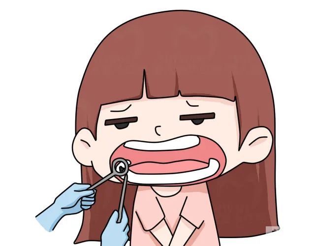 小孩子拔牙用麻药有伤害吗? 图片-2