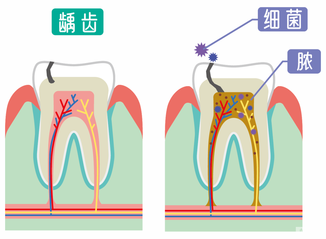 当牙齿向你发出这些“求救信号”的时候，一定要重视 图片-9