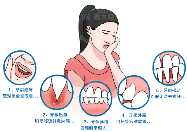 医生!我的牙龈萎缩了，能再恢复吗? 图片-7