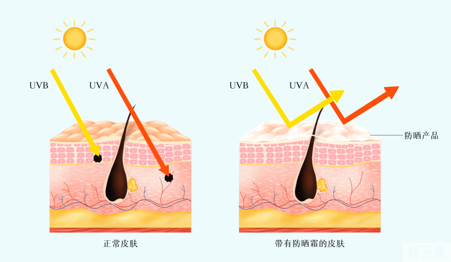疤痕变黑怎么办?怎么做才有效去黑? 图片-4