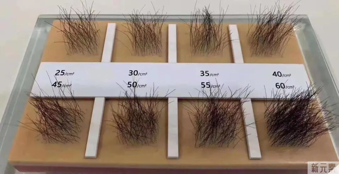 植发失败我已经会判断了，植发成功如何判断? 图片-2