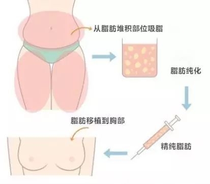 女生的胸，为什么不能乱揉? 图片-13