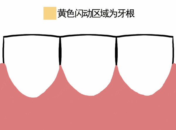 塞了牙剔掉就好?其实并没有你想的那么简单... 图片-6