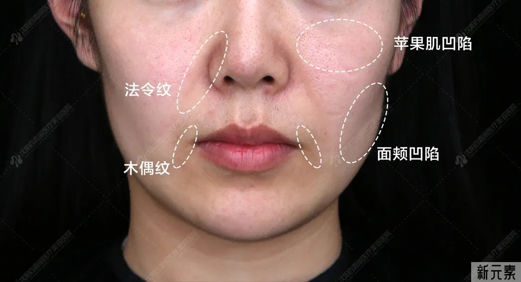 肉肉脸VS瘦瘦脸正确K老方式，可别选错了 图片-7