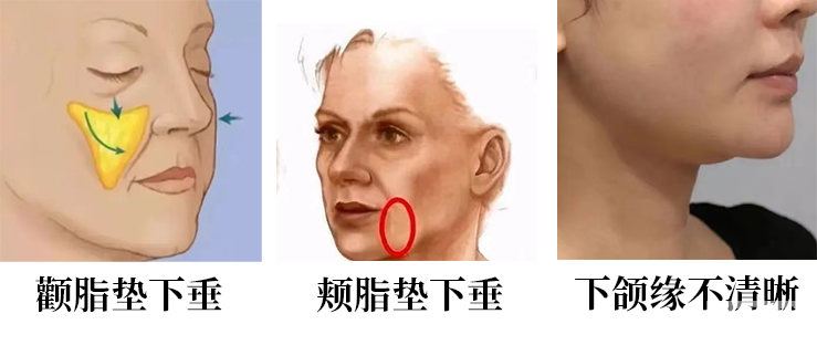 皮肤“松”和“垂”不是一回事!抗衰无效，是你思路不对! 图片-9