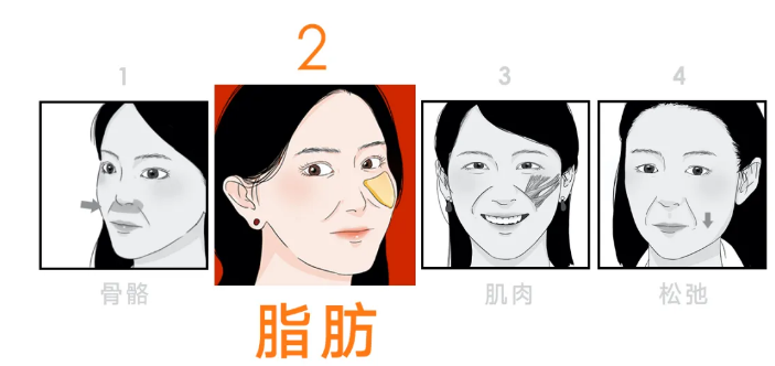 25+小姐姐法令纹明显怎么改善，这篇文章给你讲清楚 图片-7