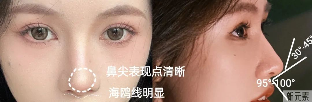 do鼻翻车的人，竟然80%都是因为这个部位... 图片-15