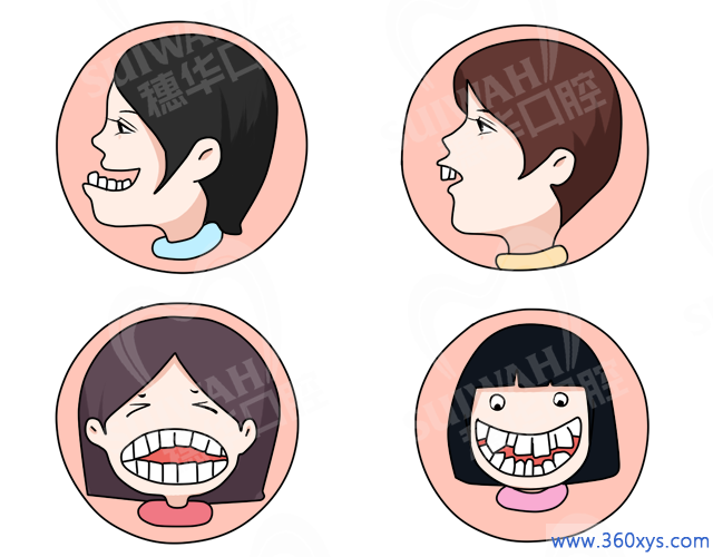 牙齿矫正的最佳年龄是什么时候？越早越好吗？ 图片-2 www.360xys.com