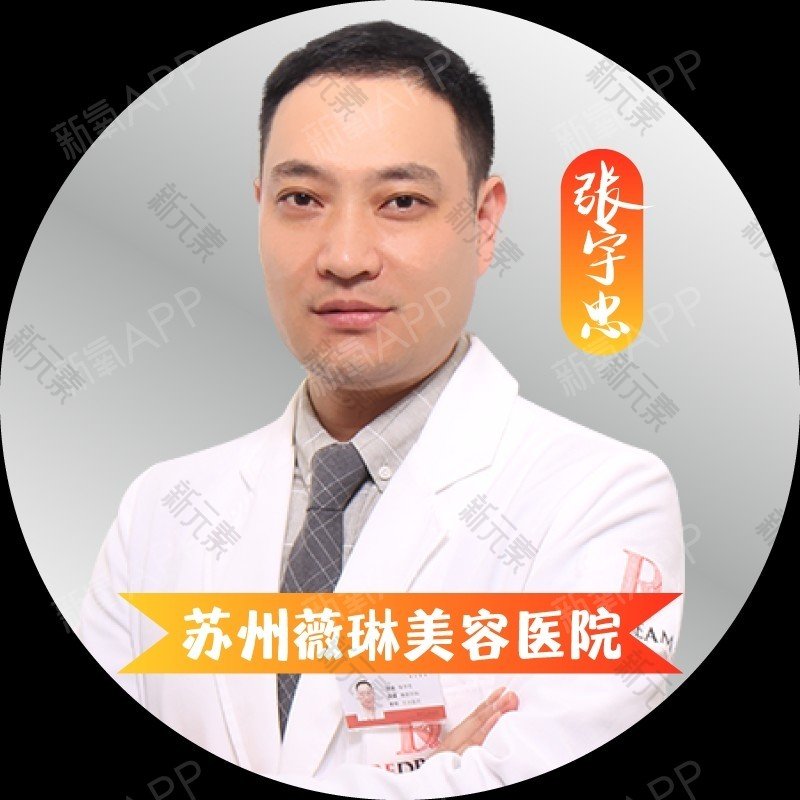 张宇忠 头像