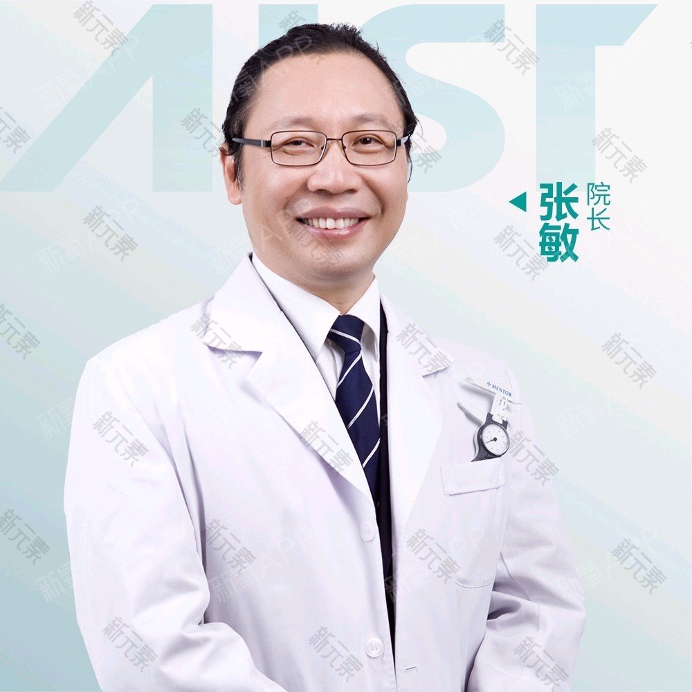 张敏