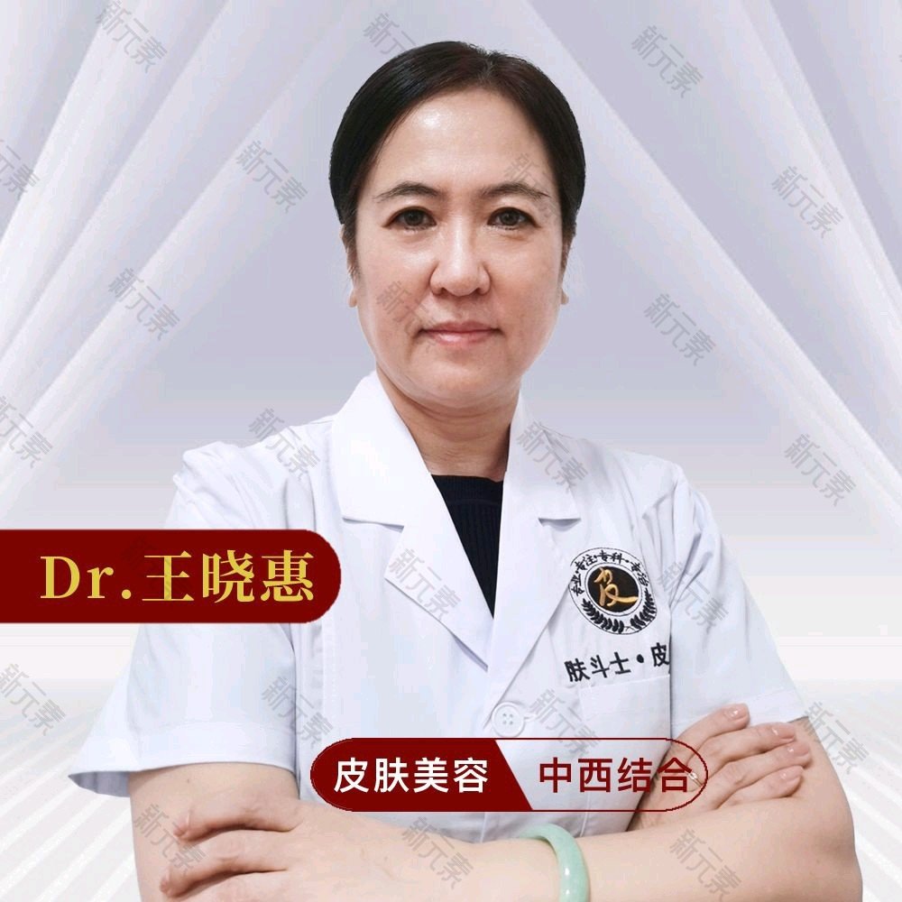 王晓惠 头像