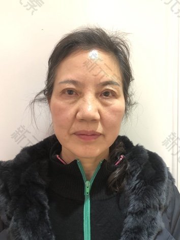 唐莉秋